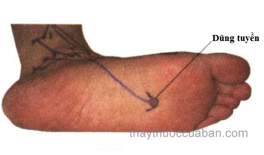 Vị trí huyệt dũng tuyền