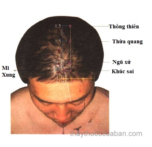 Vị trí huyệt mi xung