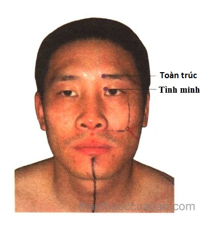 Vị trí huyệt toàn trúc